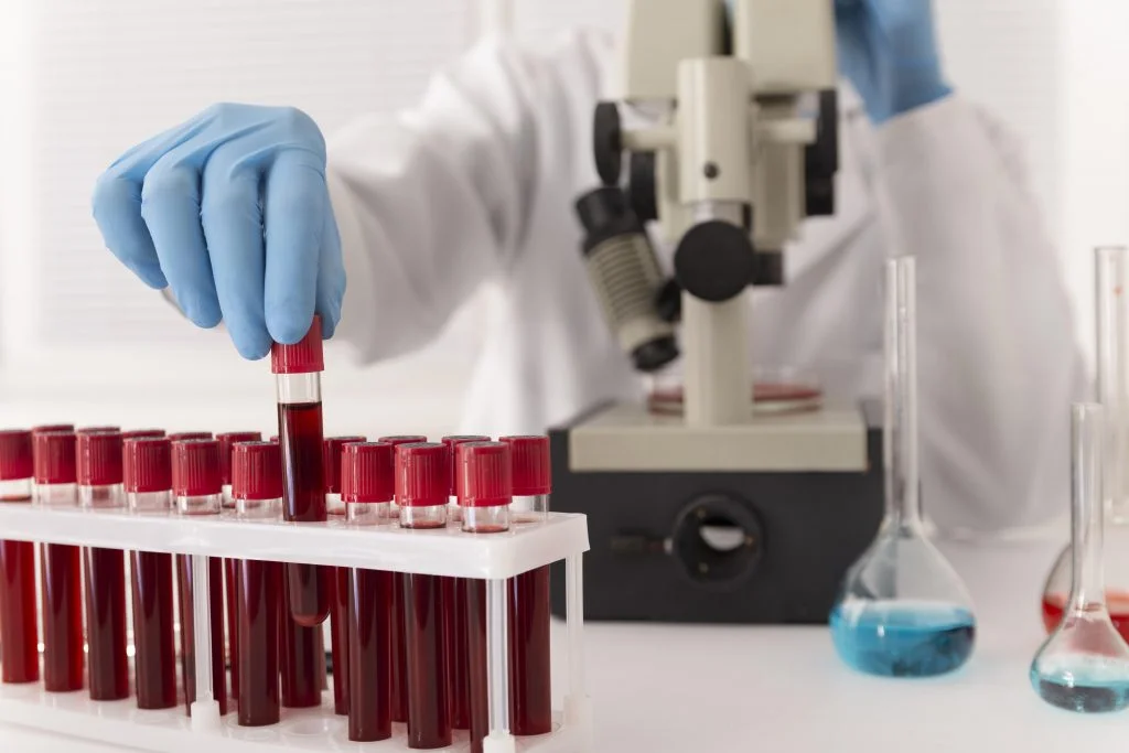 coronavirus-blood-samples-arrangement-lab
