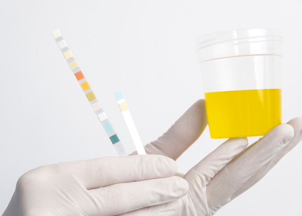 Urinalysis